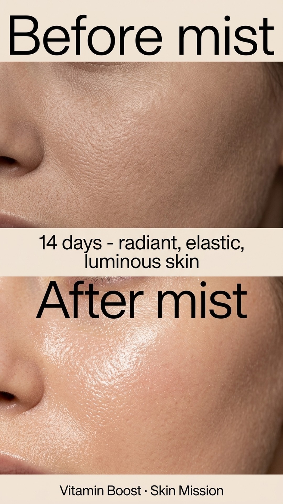 Vitamin Boost - Niacinamide + Vitamin C + E + B6 - Vitamin Serum — story 4
