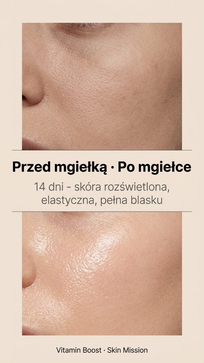 Vitamin Boost - Niacynamid + Witamina C + E + B6 - serum witaminowe